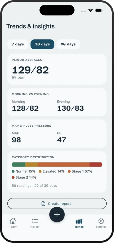 Tonelva trends view with the twin-dot chart across thirty days
